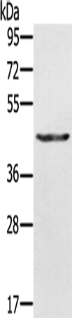 KRT31 Polyclonal Antibody – Figure 1 of 4