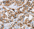 HINT2 Polyclonal Antibody – Figure 1 of 3