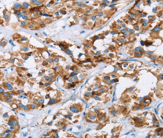 HINT2 Polyclonal Antibody – Figure 1 of 3