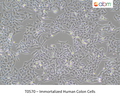 Immortalized Human Colon Cells – Figure 1 of 1