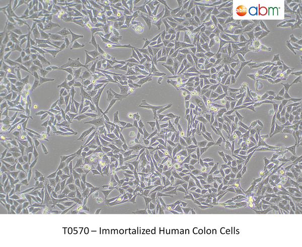Immortalized Human Colon Cells – Figure 1 of 1