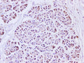 IL1A Polyclonal Antibody – Figure 1 of 2