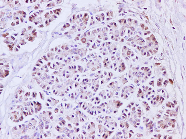 IL1A Polyclonal Antibody – Figure 1 of 2