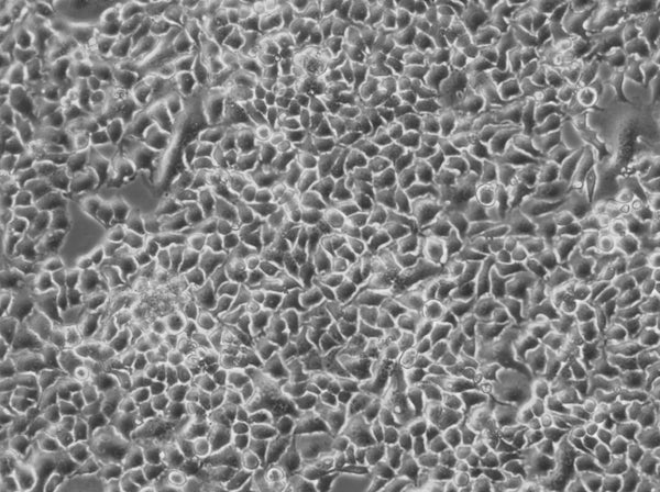 NS3-CMPK-hLBR1TM-mEGFP cell