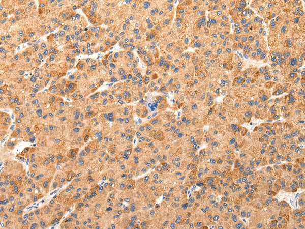 AQP7 Polyclonal Antibody – Figure 1 of 3