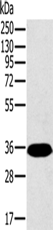 PPP2CA Polyclonal Antibody – Figure 1 of 4