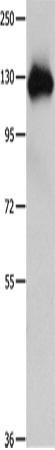 Amphiphysin I Polyclonal Antibody – Figure 1 of 2
