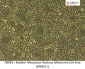 Bladder Metastasis Nodular Melanoma Cell Line (MM031) | Applied Biological Materials (abm)