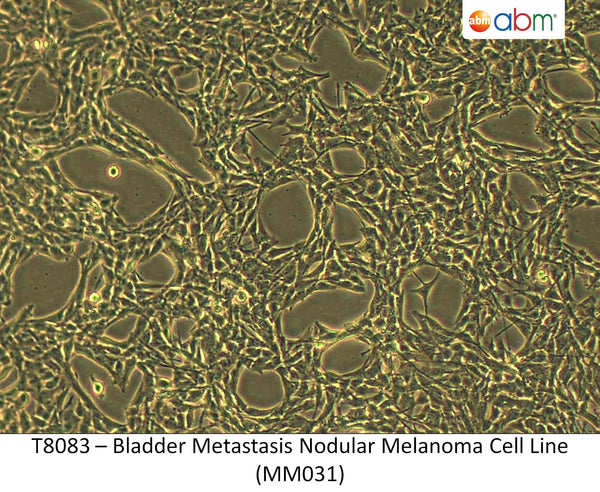 Bladder Metastasis Nodular Melanoma Cell Line (MM031) | Applied Biological Materials (abm)