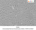Immortalized Normal Chondrocytes (NiAC)- hTERT & SV40LT – Figure 1 of 1
