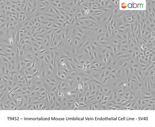 Immortalized Mouse Umbilical Vein Endothelial Cell Line - SV40 | Applied Biological Materials (abm)