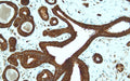 Anti-Cadherin1 (E-cadherin, CD324) – Figure 1 of 2
