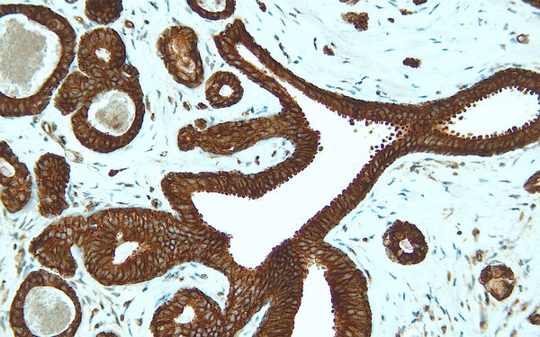 Anti-Cadherin1 (E-cadherin, CD324) – Figure 1 of 2