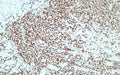 Anti-Human SOX10 – Figure 1 of 2