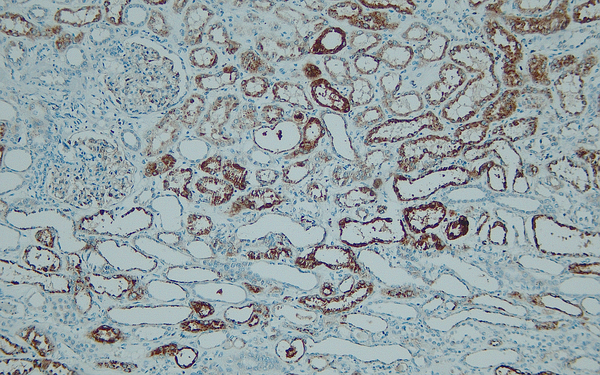 Anti-Napsin A – Figure 1 of 2