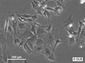 OCD cell