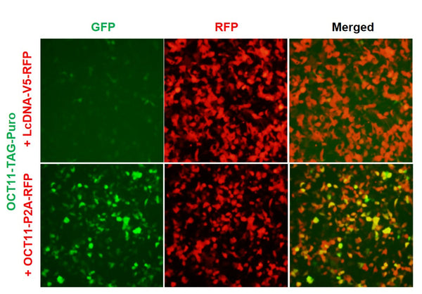 OCT11 Reporter Lentivirus – Figure 1