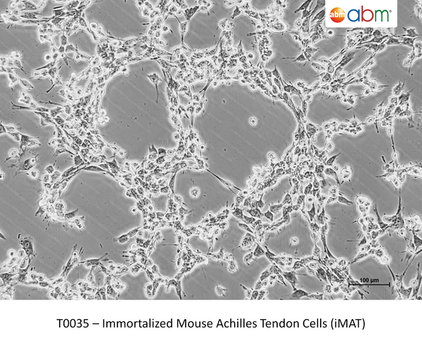 Immortalized Mouse Achilles Tendon Cells (iMAT) – Figure 1 of 1