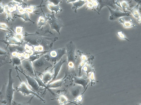 OS1-CLS cell