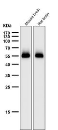 Anti-p53 (acetyl K370) TP53 Rabbit Monoclonal Antibody
