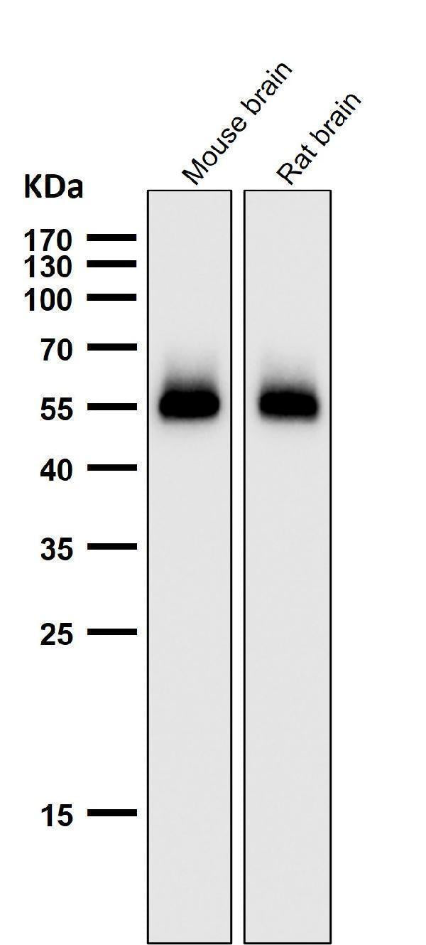 Anti-p53 (acetyl K370) TP53 Rabbit Monoclonal Antibody