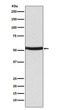 Western blot analysis of p53 (acetyl K382) expression in Jurkat cell lysate treated with etopside and TSA.