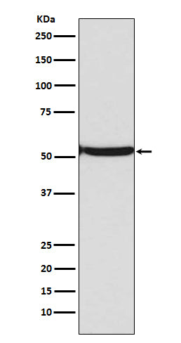 Western blot analysis of p53 (acetyl K382) expression in Jurkat cell lysate treated with etopside and TSA.