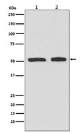 Western blot analysis of Phospho-p53 (Ser9) expression in (1)HepG2 cell lysates treated with etoposide; (2)HeLa cell lysates treated with etoposide.