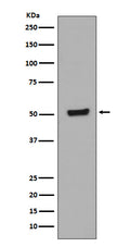 Western blot analysis of Phospho-p53 (T55) in HEK293 cell lysates treated with Calyculin A and Okadaic Acid.