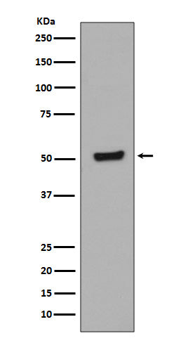 Western blot analysis of Phospho-p53 (T55) in HEK293 cell lysates treated with Calyculin A and Okadaic Acid.