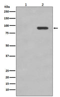 Western blot analysis of Phospho-beta Catenin (S33/S37) expression in (1) 293T cell lysate; (2) 293T cell lysate treated with calyculin A.