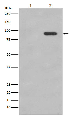 Western blot analysis of Phospho-beta Catenin (S33/S37) expression in (1) 293T cell lysate; (2) 293T cell lysate treated with calyculin A.