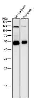 All lanes use the Antibody at 1:1K dilution for 1 hour at room temperature.