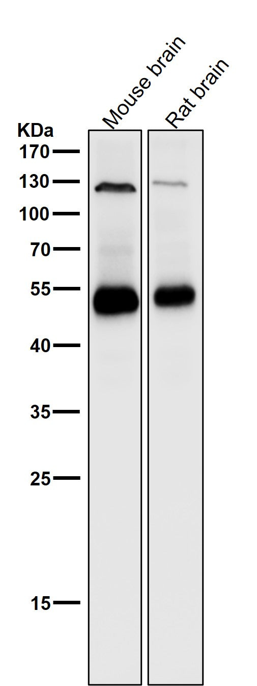 All lanes use the Antibody at 1:1K dilution for 1 hour at room temperature.