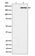 Western blot analysis of Phospho-ErbB2 (Y1139) expression in (1) A431 cell lysate; (2) A431 treated with EGF cell lysate.