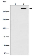 Western blot analysis of Phospho-ATM (Ser1981) in (1) HEK293 cell lysate; (2) HEK293 cell lysate treated with Doxorubicin.