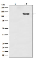 Western blot analysis of Phospho-SIRT1 (T530) expression in (1) 293T cell lysate; (2) 293T cell treated with Calyculin A.