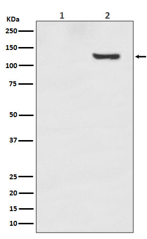 Western blot analysis of Phospho-SIRT1 (T530) expression in (1) 293T cell lysate; (2) 293T cell treated with Calyculin A.