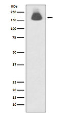 Western blot analysis of Phospho-EGFR (S695) expression in A431 cell lysate treated with EGF.