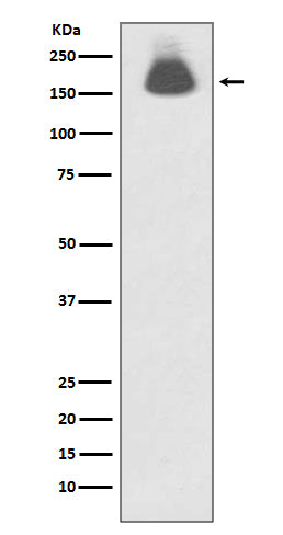Western blot analysis of Phospho-EGFR (S695) expression in A431 cell lysate treated with EGF.