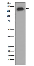 Western blot analysis of EGFR phosphorylation expression in A431 cell treated with EGF.