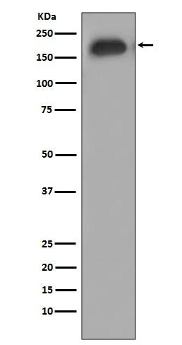 Western blot analysis of EGFR phosphorylation expression in A431 cell treated with EGF.