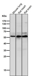 Anti-Phospho-AKT1 (S124) Rabbit Monoclonal Antibody