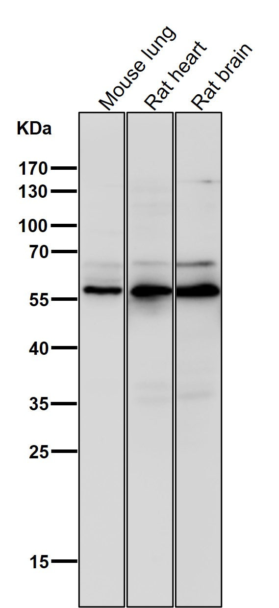 Anti-Phospho-AKT1 (S124) Rabbit Monoclonal Antibody