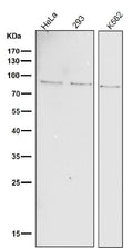 All lanes use the Antibody at 1:1K dilution for 1 hour at room temperature.