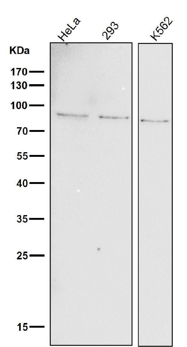 All lanes use the Antibody at 1:1K dilution for 1 hour at room temperature.