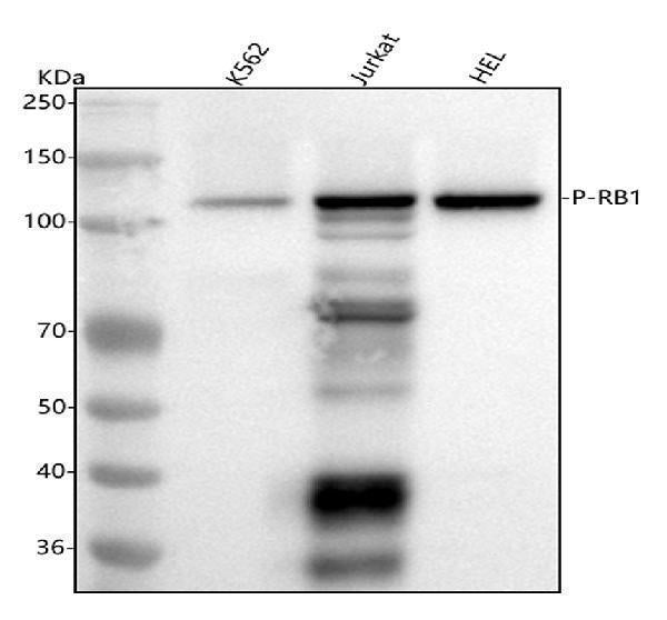 Anti-Phospho-Rb (S807) RB1 Rabbit Monoclonal Antibody