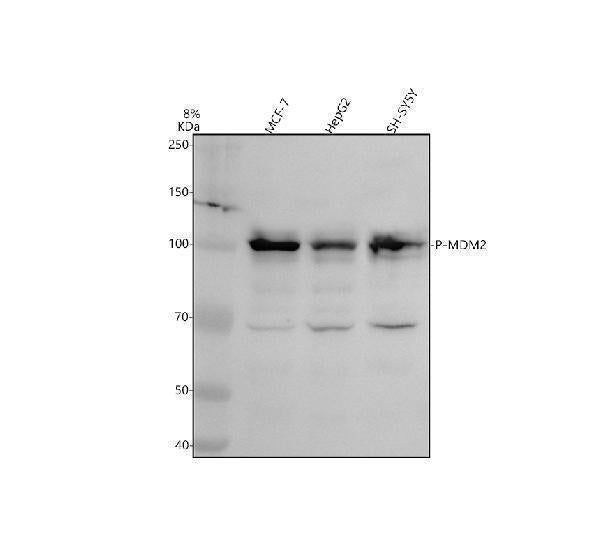 Anti-Phospho-MDM2 (S166) Rabbit Monoclonal Antibody