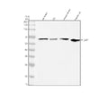 Anti-Phospho-ER alpha (S118) ESR1 Rabbit Monoclonal Antibody