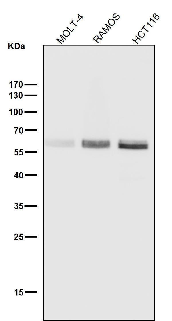 Anti-Phospho-Smad3 (S423 + S425) Rabbit Monoclonal Antibody